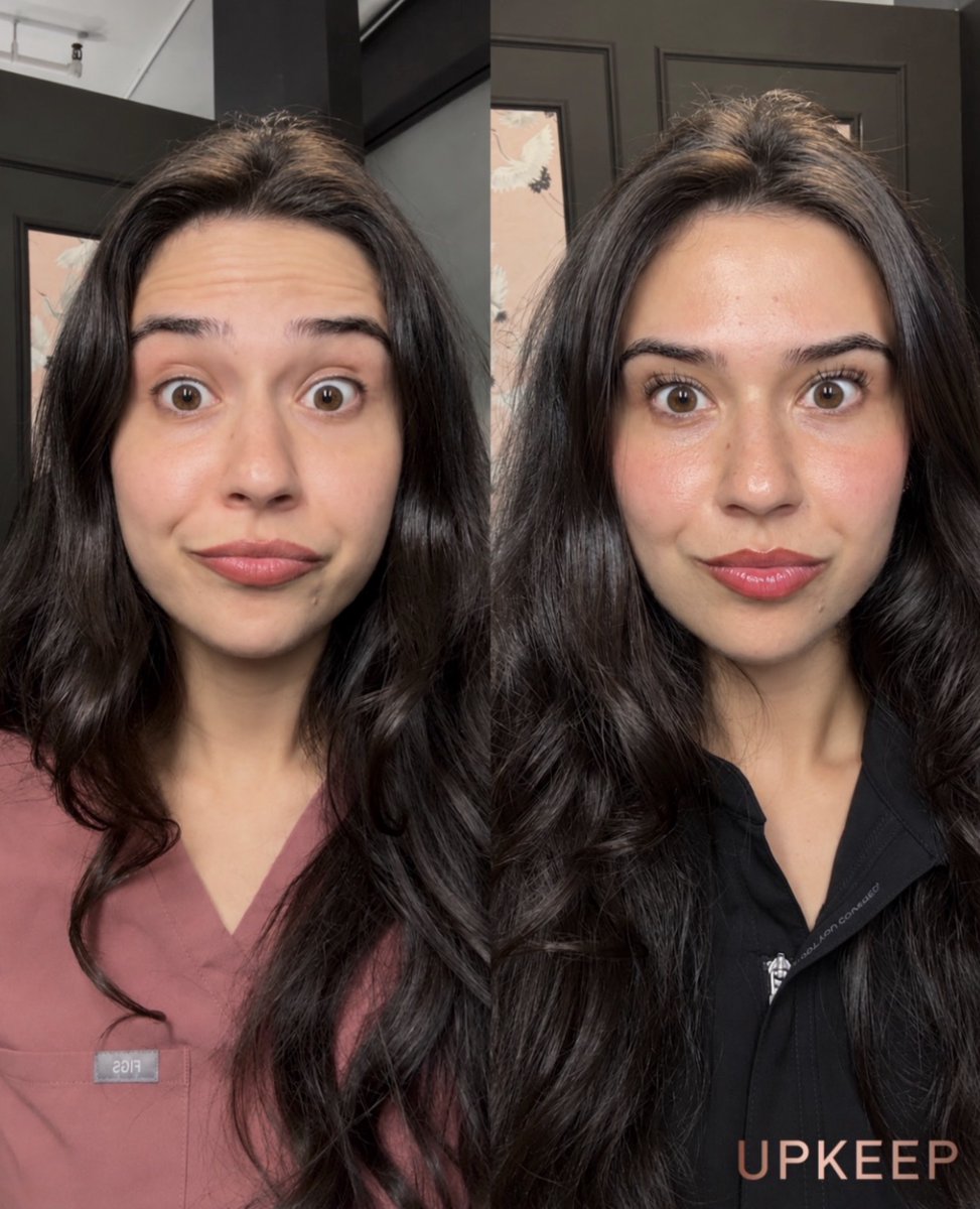 UPKEEPMEDSPA's tweet photo. A little Dysport, a personalized refresh. ✨ 

Curious about softening expression lines? Let’s talk about your goals and whether Dysport is right for you.

Book your UPKEEP consultation: https://t.co/E215qBrYlc 

#Dysport #UPKEEPMedSpa https://t.co/V8wzIQMDx4