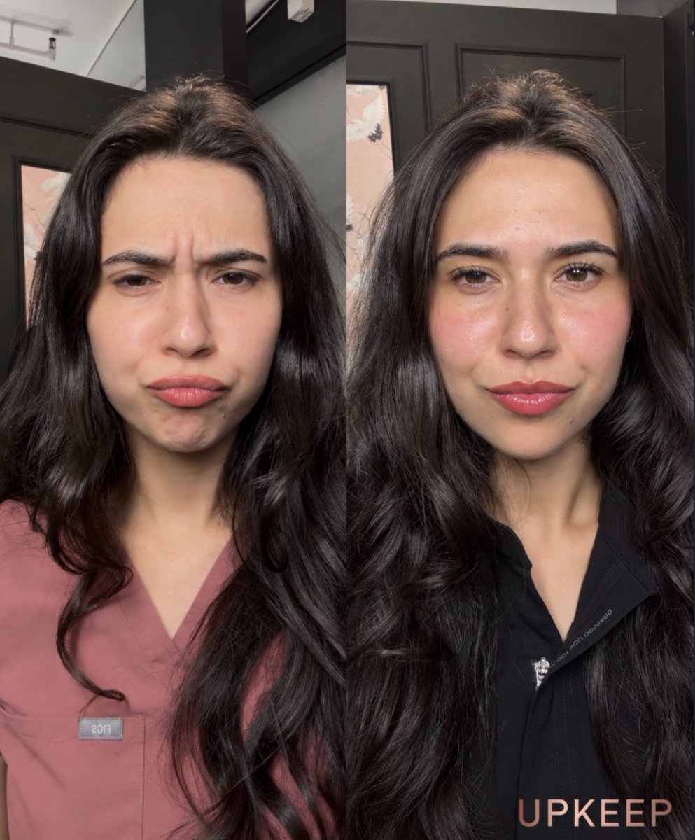 UPKEEPMEDSPA's tweet photo. A little Dysport, a personalized refresh. ✨ 

Curious about softening expression lines? Let’s talk about your goals and whether Dysport is right for you.

Book your UPKEEP consultation: https://t.co/E215qBrYlc 

#Dysport #UPKEEPMedSpa https://t.co/V8wzIQMDx4