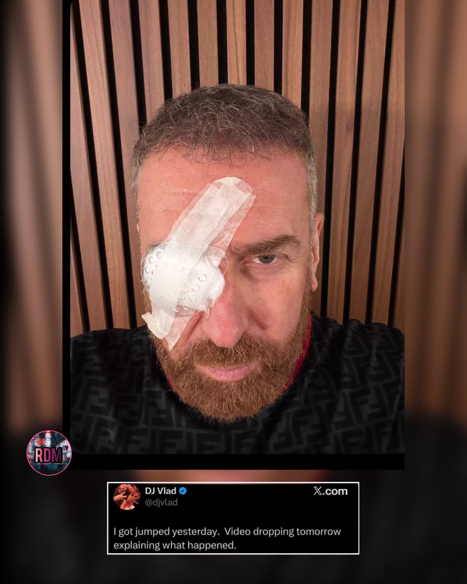 Raindropsmedia1's tweet photo. VladTV reveals he got jumped yesterday while he was outside. 👀 https://t.co/uIklDlarWf