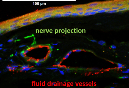 USFResearch's tweet photo. USF researchers have developed a wireless system to monitor eye pressure in real time, uncovering daily fluctuations tied to circadian rhythms &amp;light exposure. Their findings suggest timing &amp; environmental factors may influence glaucoma risk &amp; treatment.  https://t.co/Sb697O9Sle https://t.co/hvdgzoIwYH