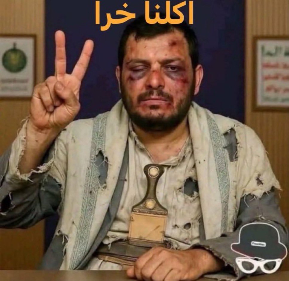 g3zopf's tweet photo. @jahafabdulsalam https://t.co/YumxvSDTsN