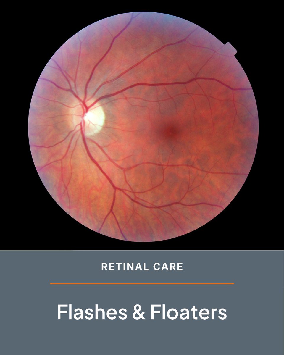 KC_retina's tweet photo. Sudden flashes or a new increase in floaters can sometimes signal a retinal tear or detachment and should not be ignored. Learn when flashes and floaters may require immediate attention: https://t.co/gQZr8qUkwM https://t.co/meaSQaijpG