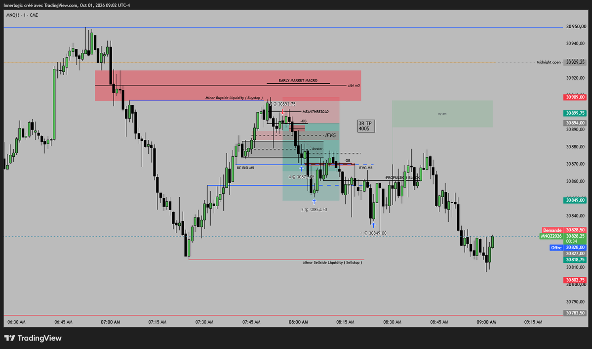 simonleprevost3's tweet photo. 1er trade avec le plan que je donne gratuitement dans mon canal telegram +3R
#trading #ict #2022model #tradify #PropFirmMatch https://t.co/R21NVTykOp