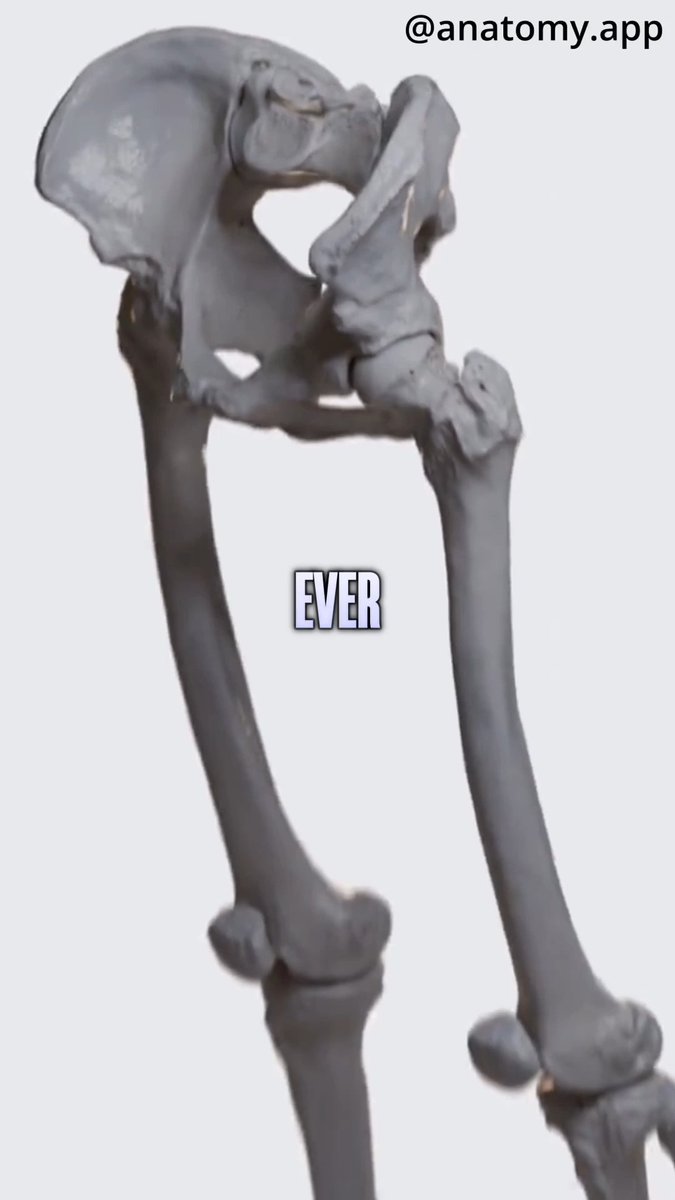 A 3D anatomical rendering of a human pelvis and leg bones shows the pelvis tilted forward with the text "EVER" overlaid, alongside the handle "@anatomy.app." This illustrates the post's explanation of how pelvic anterior tilt causes hip tendons to snap during leg raises.