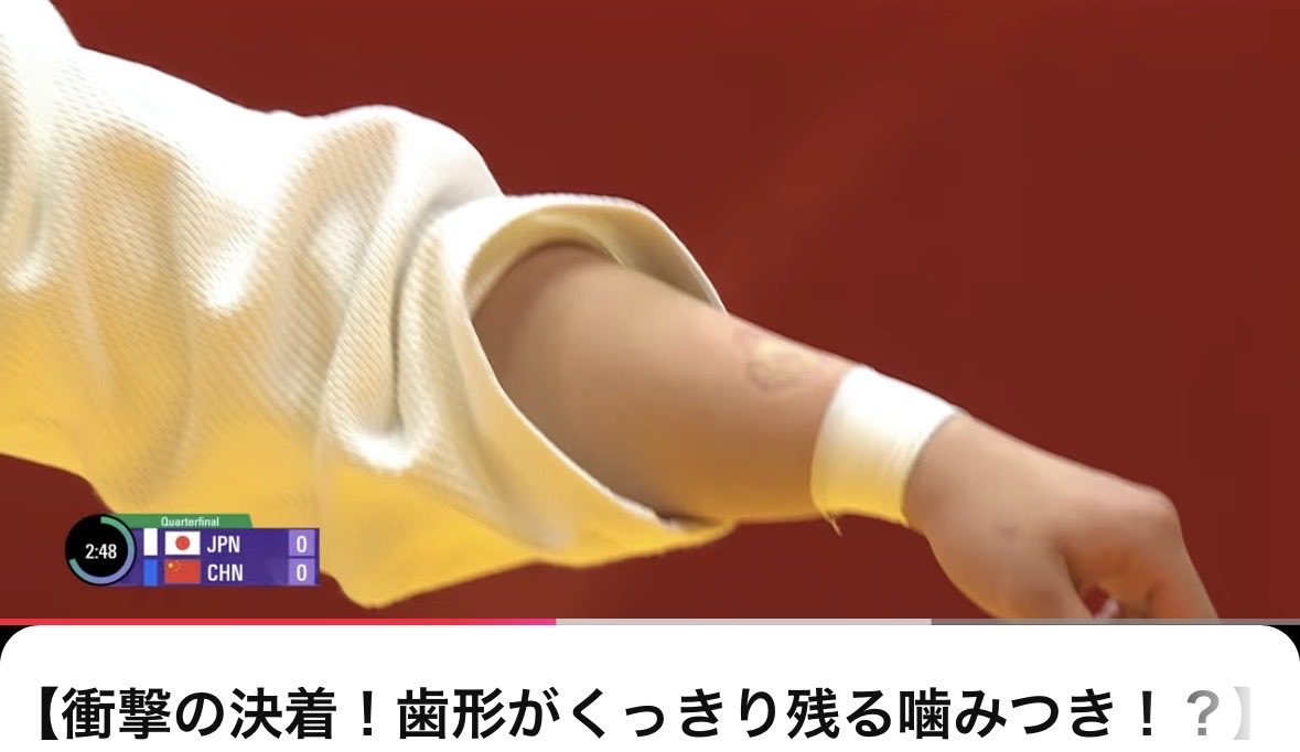 Parsonalsecret's tweet photo. 女子柔道で中国選手が日本選手（前田凛）に20秒以上噛みつき反則負け

中国のSNSではメンツなんかより日本人を「傷付けた」こととして英雄みたいに讃えられている。

本当に惨めで低俗な国民だな https://t.co/z7k4AXlm31