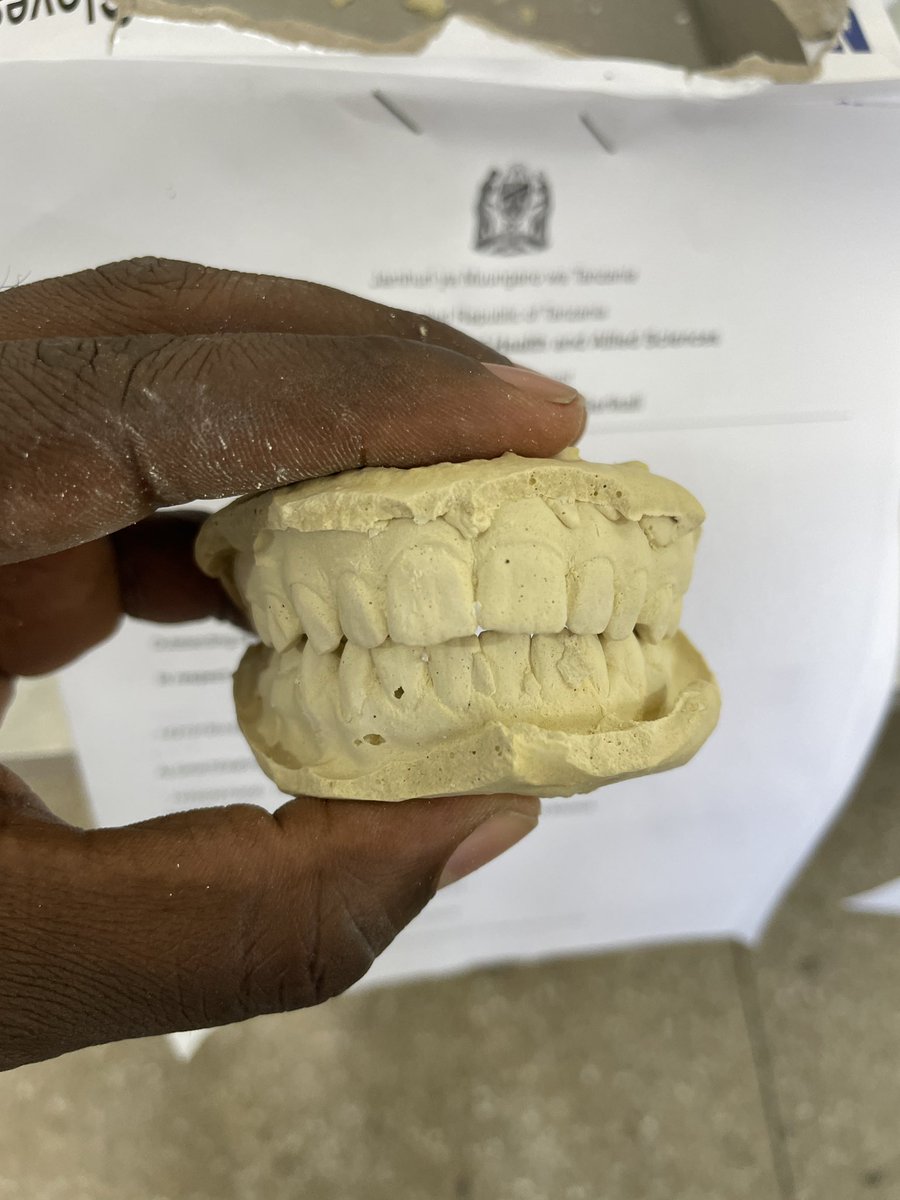 DrMuyabin's tweet photo. Umewahi kujiuliza kwanini ukienda kufanya matibabu ya mpangilio wa meno ( braces) unachukuliwa kipimo cha kutengeneza kitu kama hiki? https://t.co/ClcrnqRQkr