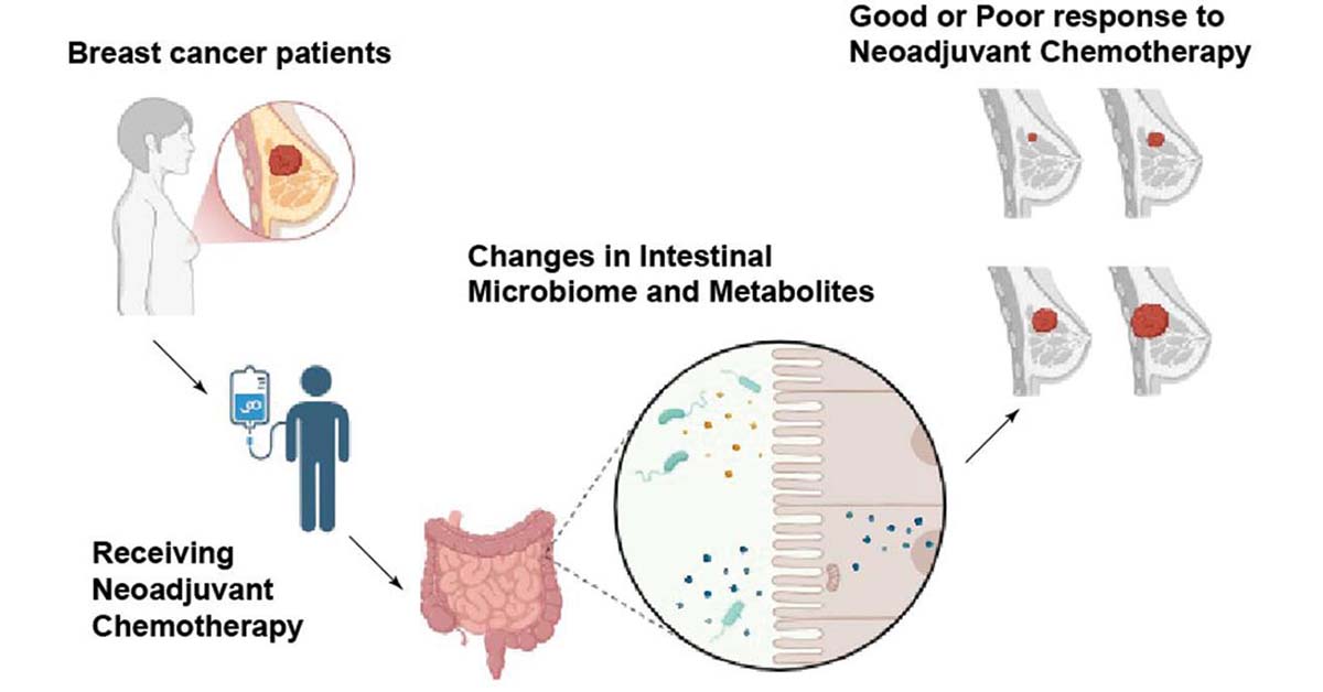 JournalBio's tweet photo. Neoadjuvant chemotherapy alters intestinal microbiota & metabolites, with Fusobacterium & key pathways linked to therapeutic response, offering predictive & therapeutic potential. #Oncology #BreastCancer #Chemotherapy
#BIOI #OpenAccess: https://t.co/xJz85woXFi https://t.co/ckRIA2xcnv