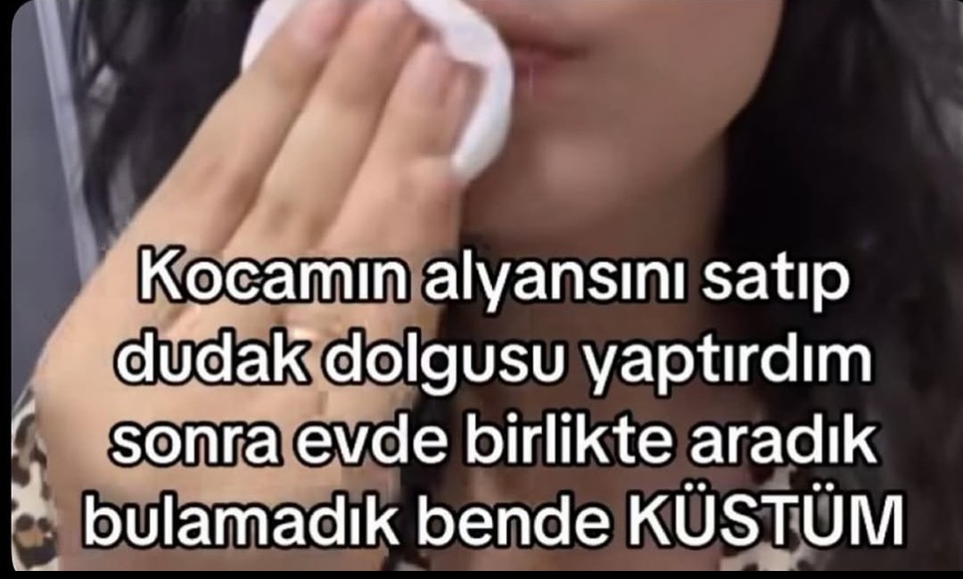 artikbidur's tweet photo. var misin bu aski benimle yasamaya https://t.co/Z0eD16xZNe