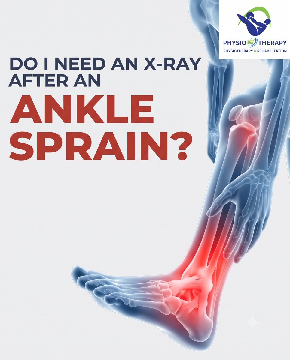 Anilkumar796378's tweet photo. 🦶 Do you need an X-ray after an ankle sprain?
Not every sprain needs an X-ray.
Get checked if you have:
✅ Trouble walking
✅ Severe bone pain
Physiotherapy helps restore ankle strength &amp; stability.
🏠 Home Physiotherapy Delhi
📞 +91 73021 72756
#AnkleSprain #Physiotherapy https://t.co/DoxOol0mQn