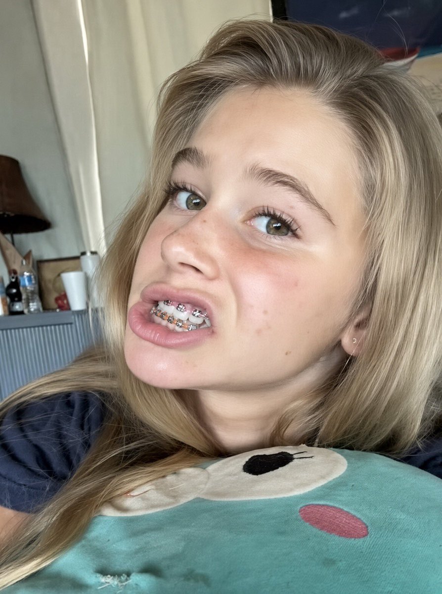 leaky4goddesses's tweet photo. Ngggghhhhh I am a dirty disgusting perv for bop brace face 😵‍💫💖💦 https://t.co/a2KaDjAji9