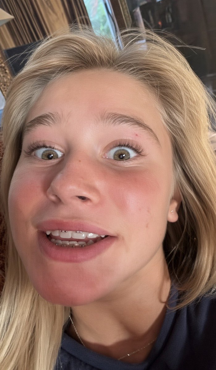 leaky4goddesses's tweet photo. Ngggghhhhh I am a dirty disgusting perv for bop brace face 😵‍💫💖💦 https://t.co/a2KaDjAji9
