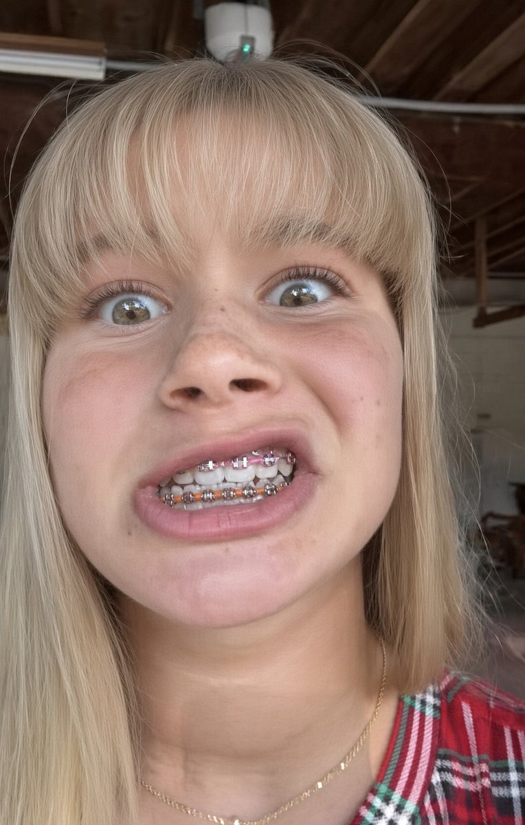 leaky4goddesses's tweet photo. Ngggghhhhh I am a dirty disgusting perv for bop brace face 😵‍💫💖💦 https://t.co/a2KaDjAji9