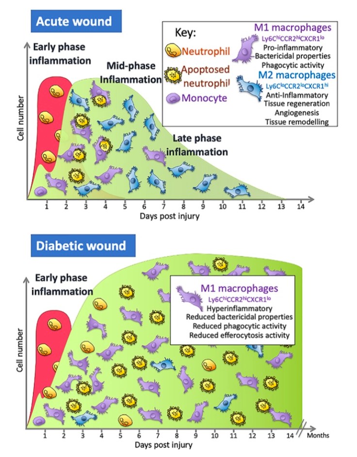 DGArmstrong's tweet photo. Mixed up Macrophages: M1/M2 Dysregulation in Diabetic Foot Ulcers https://t.co/5CiEXjR8QY https://t.co/06NwXgpqJY