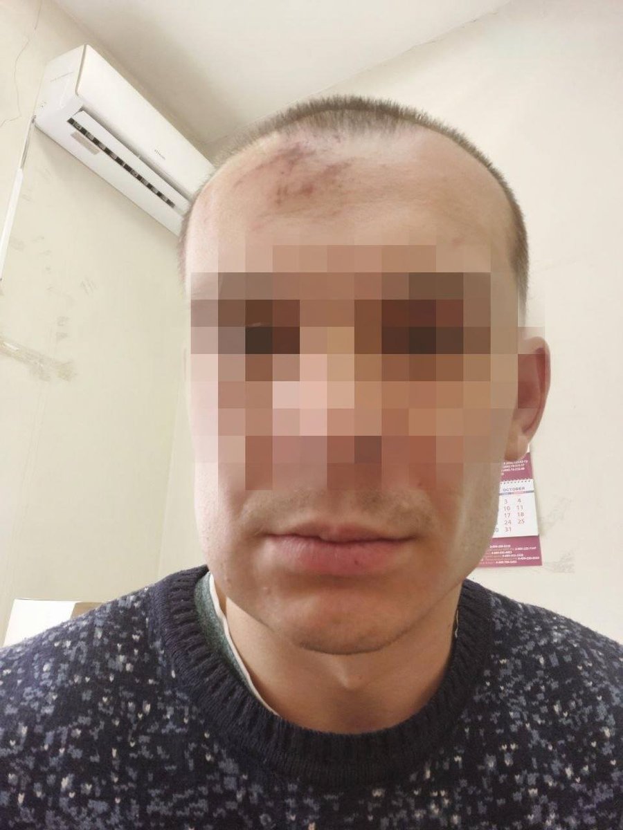 gozefinagold's tweet photo. Интернет-тролля, который выступал против «хохлов», сочувствующая им девушка из комментариев пригласила на «свидание», где его жестоко избили толпой и пробили голову
Внушительную часть своего рабочего времени строитель Александр из Москвы проводил в комментариях к постам сразу ⬇️ https://t.co/kzvA3W5SXO