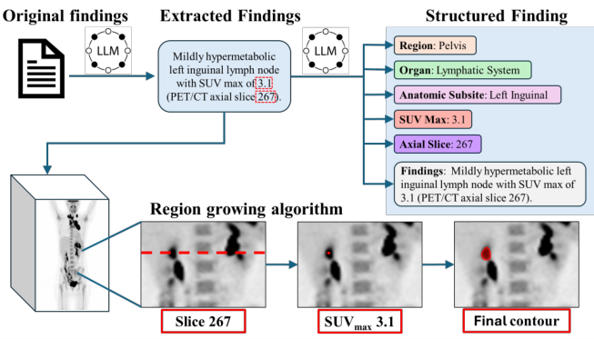 papersdatacode's tweet photo. 📊 PETARSeg-11K by UW-Madison-Dept-Radiology

Contains 11K-scale PET/CT data with lesion-level correspondences between localized abnormalities and free-text radiology findings.

Key points:
• 11K-scale dataset
• PET/CT imaging paired with text
• Lesion-level spatial grounding annotations

Useful for training and evaluating lesion-grounded PET/CT report generation and vision-language models.

📥 126 downloads