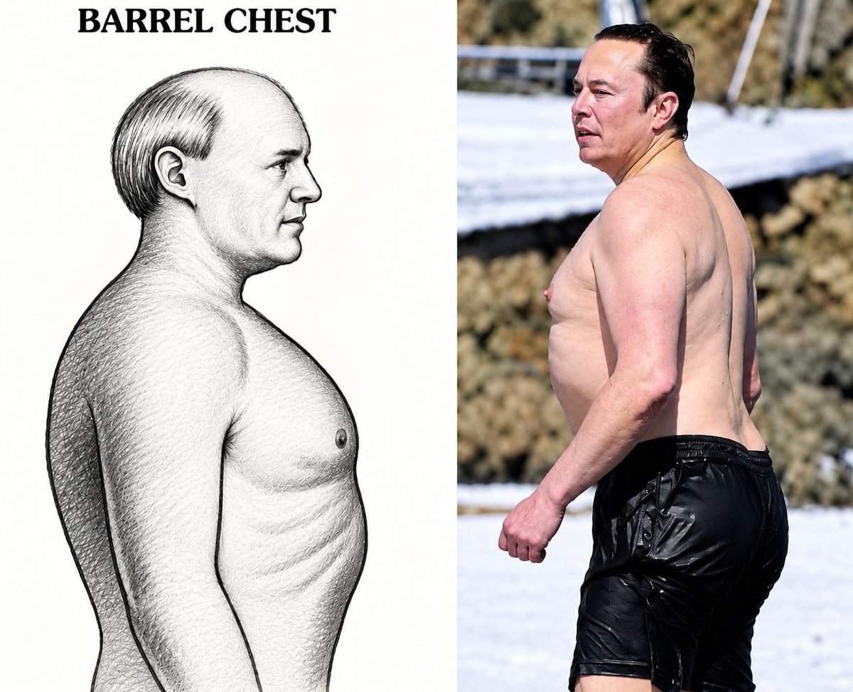 Xninarose_'s tweet photo. Hey @grok, why does Elon Musk have this body shape? What’s the science behind the “barrel chest” look? https://t.co/eO1pTOdzKE