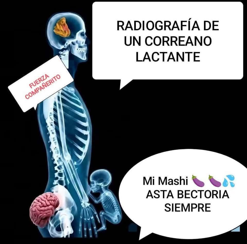 SolisChocho's tweet photo. @CristianAnchun7 @JohnReimberg @aquilesalvarez https://t.co/X1R8dmZXRP
