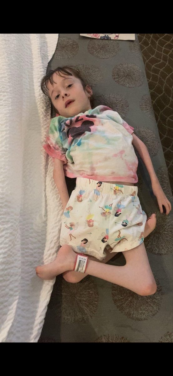 MairinNolaczy1's tweet photo. CHI told us she would have her hip surgery every year for 3 years. Then  told  us they could do it in cappagh.The  years went by and no surgery appointment came.  No explanation why we were waiting. Still children who didn’t need hip  surgery had it done.
#BackUs #scoliosis https://t.co/nj0Agmyt3y
