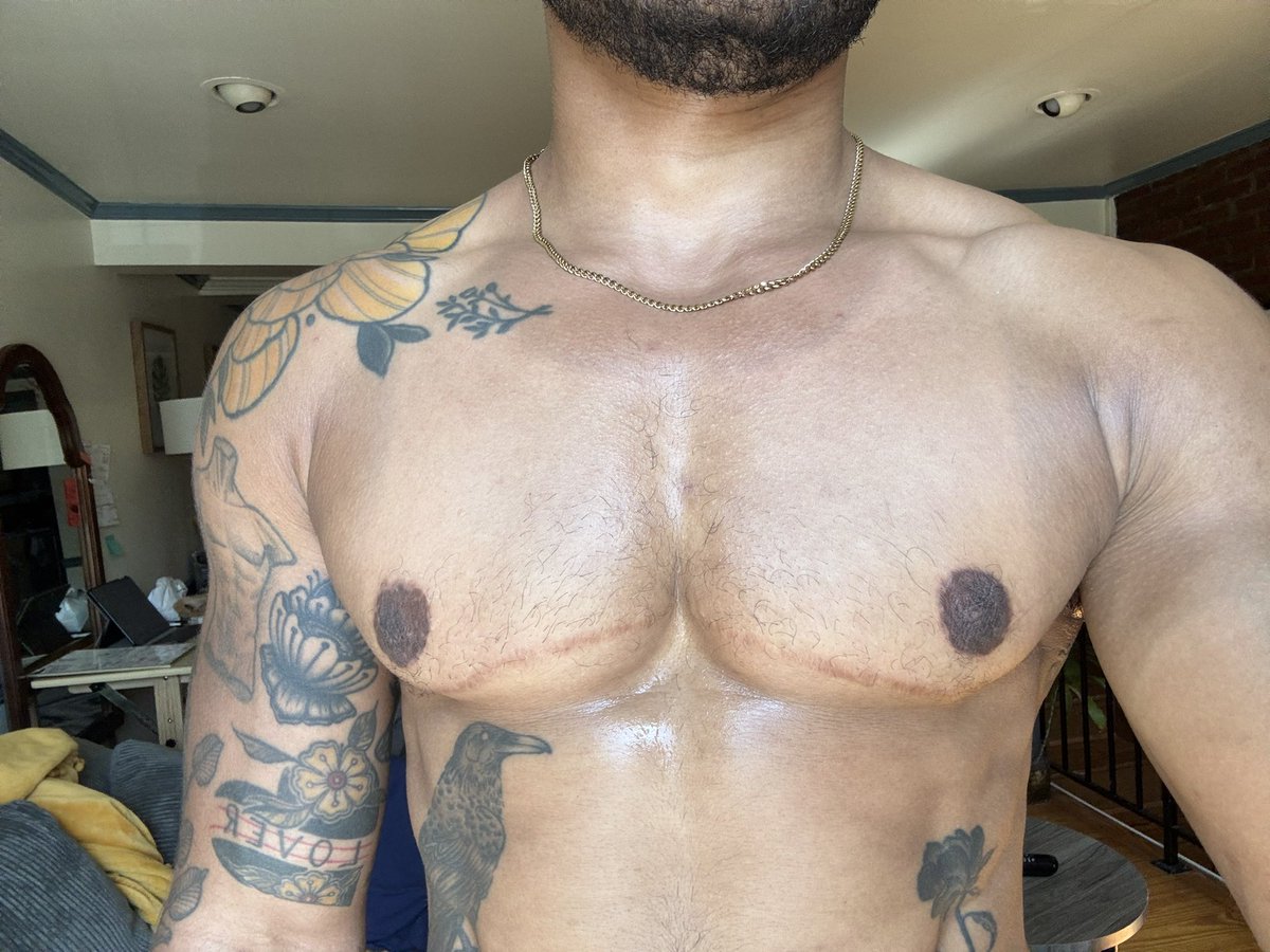 RainRansom's tweet photo. got this less than ideal tan during my walk, chest hairs finally come in tho https://t.co/oQ8LTn9ND1