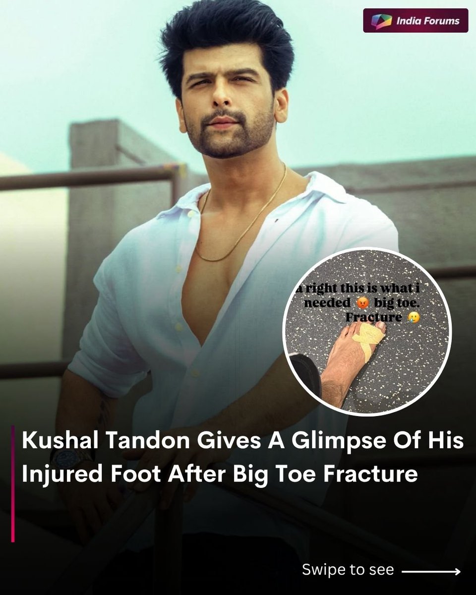 indiaforums's tweet photo. Kushal Tandon shared a glimpse of his injured foot after suffering a painful big toe fracture, giving fans an update on his injury. 😭
📸 @therealkushaltandon
.
.
.
#KushalTandon #Injury #BigToeFracture #TVActor #IndiaForums https://t.co/ApUNLoNGC2