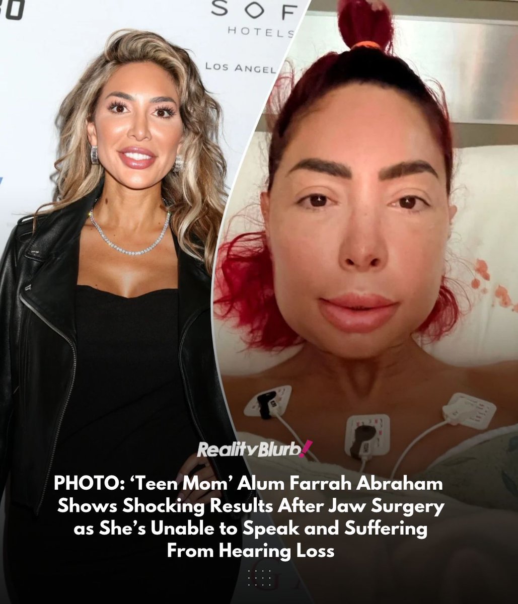 Farrah Abraham jaw surgery Farrah Abraham post jaw surgery swollen face