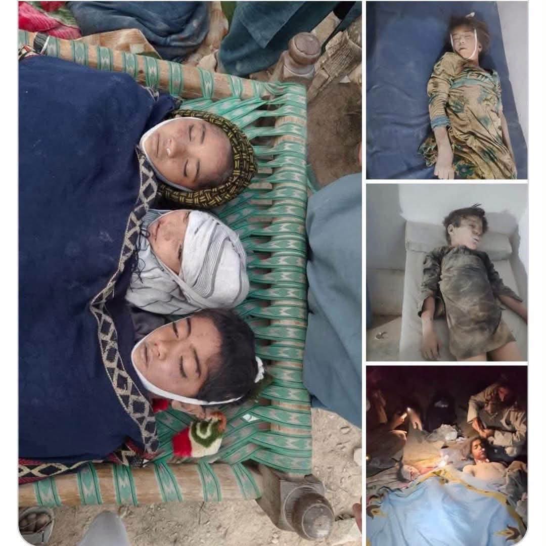 ghazi_pashteen's tweet photo. تیره شپه په بر وطن افغانستان کې د استعماري او جابر پاکستاني ریاست له خو په کونړ او هلمند کې په عام اولس باندې هوایی بریدونه وشول چې په نتیجه کښې یې ماشومان ، ښځې او عام اولس شهیدان او ټپیان شول او کورونه یې ورته کنډر کړل.
پاکستان د غټو قوتونو په ښوښه جوړ کړي شوي ریاست دي،په جنوبي ایشیا کې تر ډیره حده ترهګري او بې خونده ژوند د پاکستان د هغو پالیسیو د لاسه دي چې د دوي پلارونه یې ورته جوړه وي.
د پاکستان جوړښت سره سره په افغان وطن کې د پښتنو افغانانو وژنه شروع ده چې تر اوسه یې لړۍ روانه دا،او اوس خو یې ښه په سپین سترګي سره کوي.
پاکستان یو Baby Killer State دي،تل یې ماشومان ښځې او غریب اولسونه وژلي، خو د طاقتورو قوتونو مخې ته په سجده پروت وي.

#WhereIsPTMDelegation
