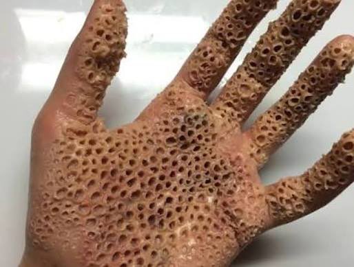 ianoo5_'s tweet photo. What would make someone's hand be like this? https://t.co/3Cno6Sb0bN