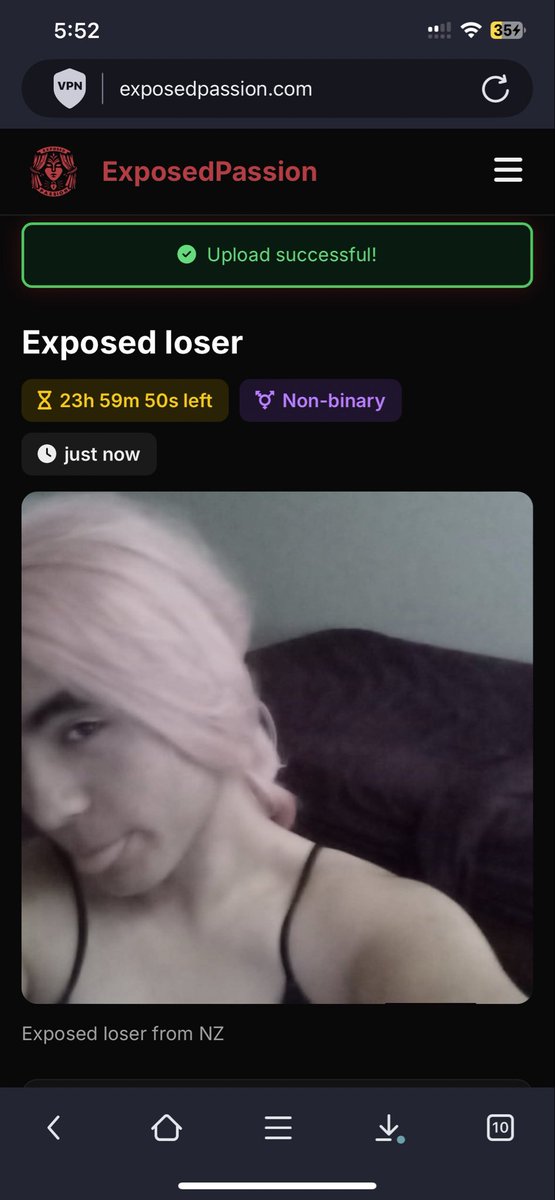 VenomQnOlivia's tweet photo. Lizzy the exposed loser from NZ just got uploaded to ExposedPassion. Pink wig on, miserable face out, full sissy possession for everyone to see. No hiding now, the shame is permanent. Cry about it, sissy. #Exposed #Sissy #ForceFem #Humiliation https://t.co/Ke20BLpiLf