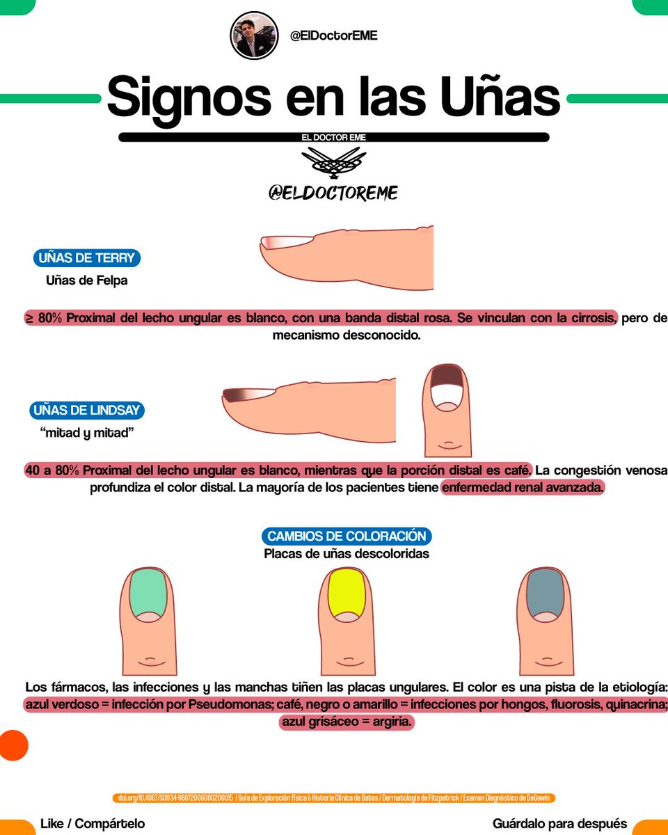 eldoctoreme's tweet photo. 🤓GUÍA RÁPIDA: SIGNOS EN LAS UÑAS🤓
📌Hilo con📌

•Nombre del Signo
•Descripción
•Etiologías
•Ejemplo

Encuentra más información en https://t.co/NPENohmrHa

#ENARM #MIR #USMLE #ENARM2026 https://t.co/aEOPPBJ0SD