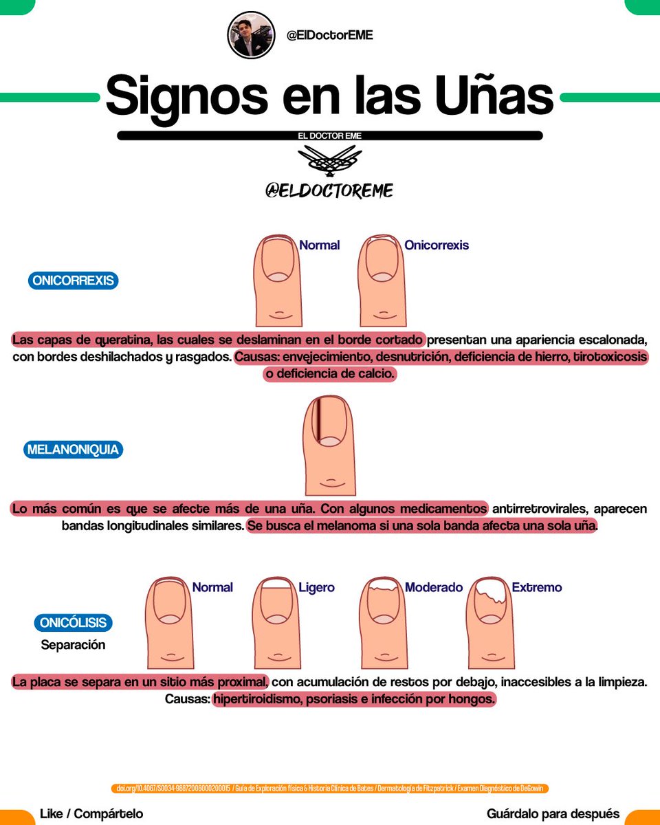 eldoctoreme's tweet photo. 🤓GUÍA RÁPIDA: SIGNOS EN LAS UÑAS🤓
📌Hilo con📌

•Nombre del Signo
•Descripción
•Etiologías
•Ejemplo

Encuentra más información en https://t.co/NPENohmrHa

#ENARM #MIR #USMLE #ENARM2026 https://t.co/aEOPPBJ0SD