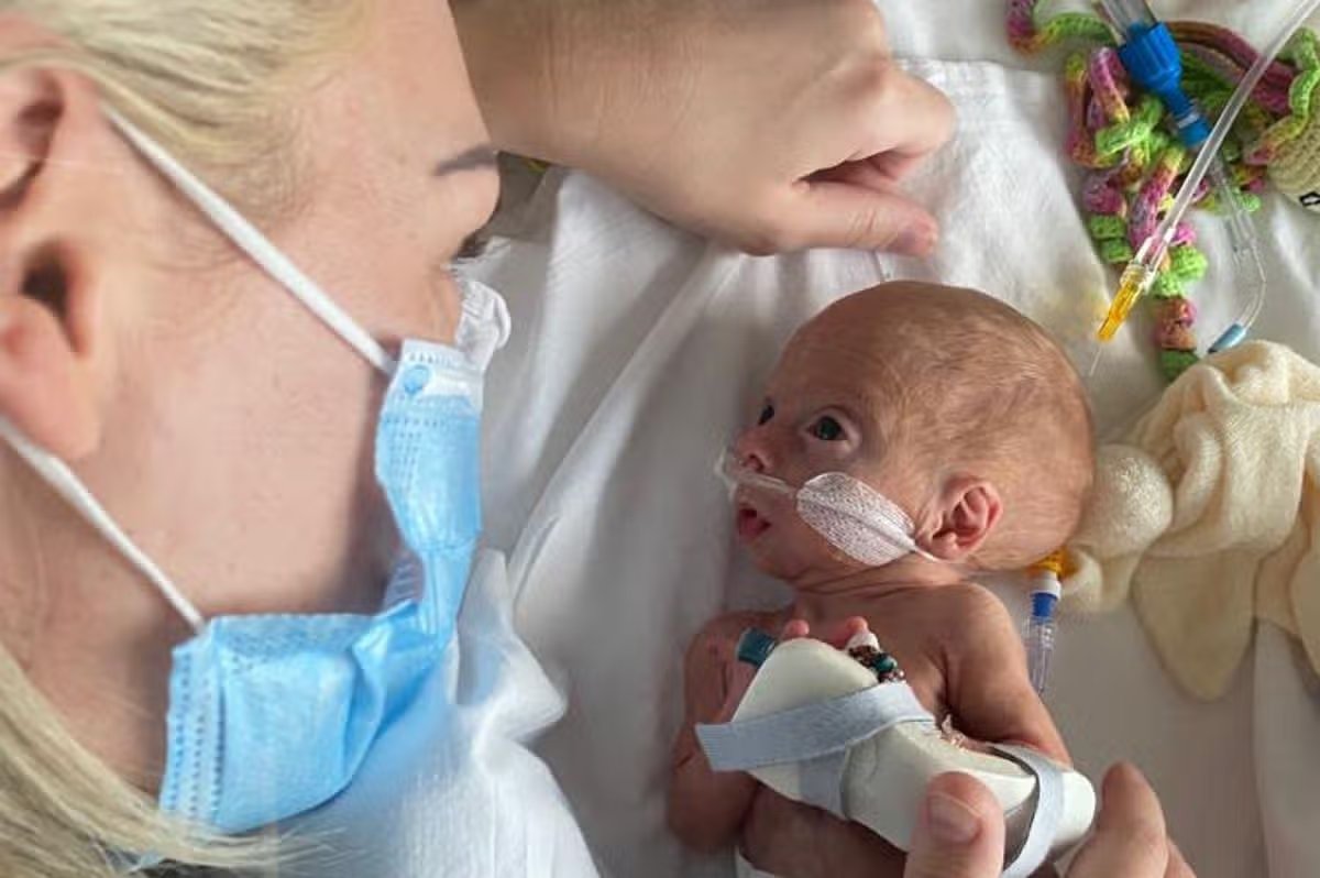 LifeNewsHQ's tweet photo. This is little Coran.

He was born 12 weeks early. He's valuable and worthy of life.

And thankfully his parents fought hard for him. So hard that now he's going to school!

See below for a picture of his beautiful family. https://t.co/uI5nnMwaeS