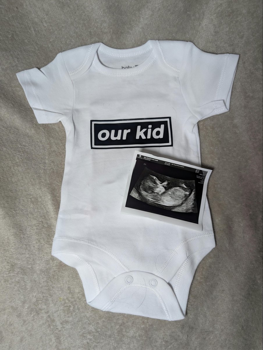 yhellokayleigh's tweet photo. Still mega jealous of everyone who got @oasis tickets, but we need to save our pennies…

Because we’re having a baby! 🤰🏼🙏🏼

After 10 years of infertility and several losses, we’re incredibly grateful to be having a baby of our own. 💛

You + me = Baby B 👶🏼 https://t.co/chR0AHj1uV