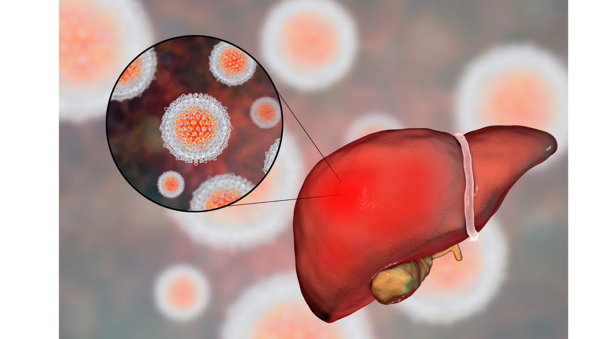 recuentode's tweet photo. PROMUEVE IMSS VERACRUZ NORTE PREVENCIÓN Y DETECCIÓN OPORTUNA DE HEPATITIS C https://t.co/zWw11bNm2u https://t.co/pRXrImHhUv