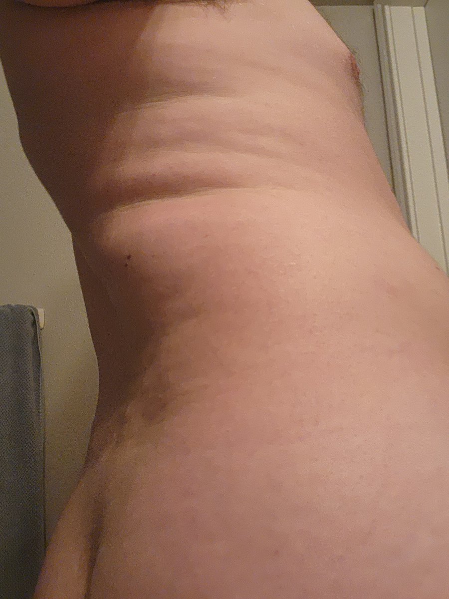 bigbo_operboy's tweet photo. Is that what I think it is?👀
Finally getting love handle stretch marks!!!🤭
Anyone wanna help put more onto this body?😉
#fat #fatter #fatty #obese #gainer #malegainer #gay #stretchmark #stretchmarks #obesity #belly #bigbelly #butt #feedee #feeder #feederism #growing #weight https://t.co/5LNYVok89x