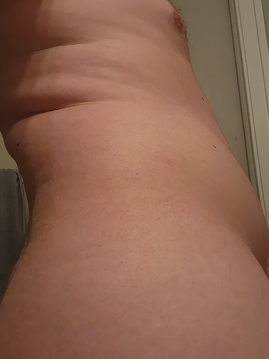 bigbo_operboy's tweet photo. Is that what I think it is?👀
Finally getting love handle stretch marks!!!🤭
Anyone wanna help put more onto this body?😉
#fat #fatter #fatty #obese #gainer #malegainer #gay #stretchmark #stretchmarks #obesity #belly #bigbelly #butt #feedee #feeder #feederism #growing #weight https://t.co/5LNYVok89x