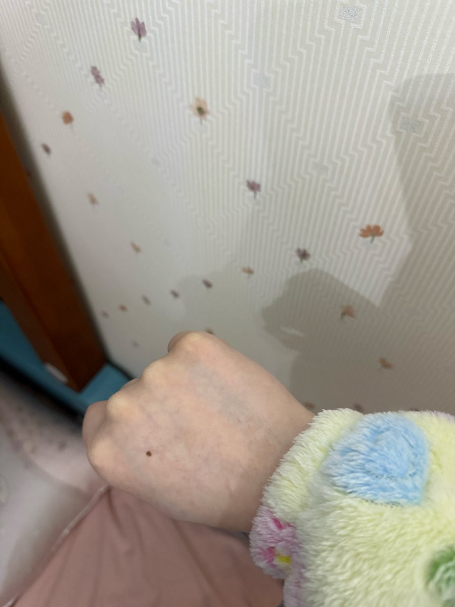 kkdpacmm's tweet photo. 太冷了导致肚子一直乱叫想放屁 肚子上和腰上都贴了暖宝宝 还贴了脚踝发热贴 脚才有了知觉 贴之前脚已经冻麻了 我真挺讨厌来暖前这半个月的 太难熬了 干燥导致我的手背很容易扇 可是我习惯每天洗很多次手了 涂了护手霜还是这样 于是今天买��身体油 希望你对得起你的价格。。 https://t.co/arilYQo1om