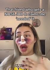 Im_Cyber_IRL's tweet photo. I got approved for surgery!!!!! https://t.co/lOfujuFHdD