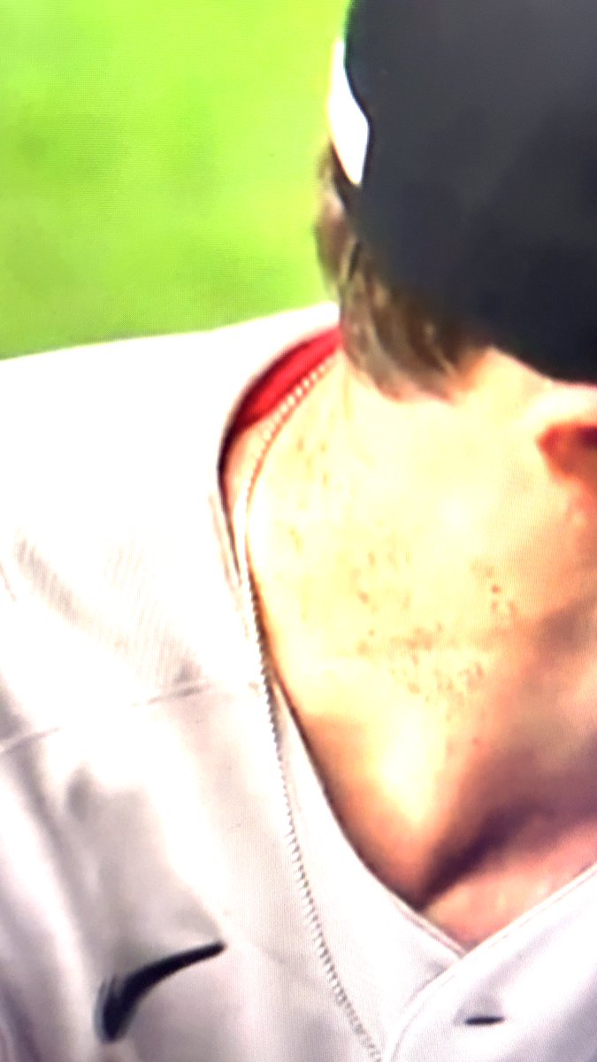 Elrealjaiocho's tweet photo. @mike_daddino So that not pine tar.  they don’t give a dirty ball back so you full of shit smh https://t.co/OLt1JmB5vy
