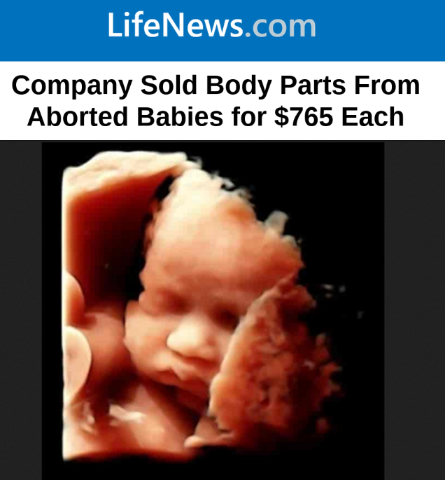 LifeNewsHQ's tweet photo. BREAKING: A company that harvests organs from aborted babies has been caught selling the body parts for $765 each.

Cercle Allocation Services sold 21 aborted baby parts -- 14 livers and 7 thymus glands -- to taxpayer-funded University of California laboratories.

More below... https://t.co/H26hLNJeTZ