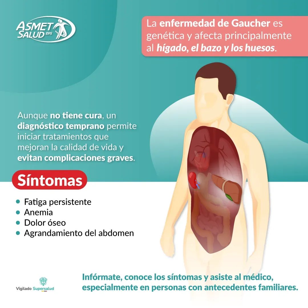 AsmetSalud's tweet photo. 🧬 Te invitamos a conocer más sobre esta enfermedad genética y algunos de sus principales síntomas, como fatiga persistente, anemia, dolor óseo y aumento del abdomen. Un diagnóstico oportuno permite iniciar tratamientos y contribuir a una mejor calidad de vida. https://t.co/5Uf8rA2RBb