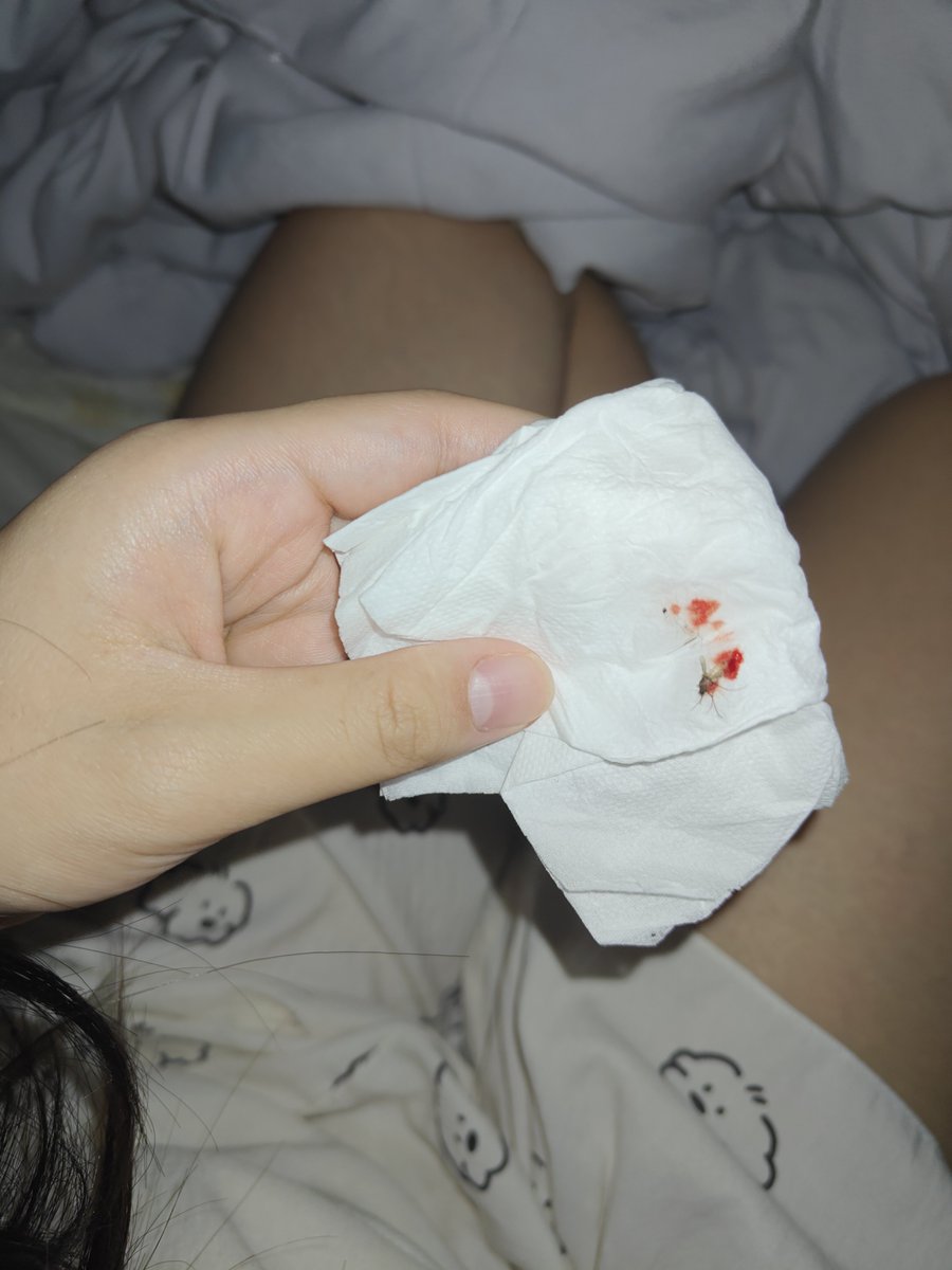 cheese666u's tweet photo. 死蚊子终于搞死了 害我睡不好 https://t.co/AucWsCTltY