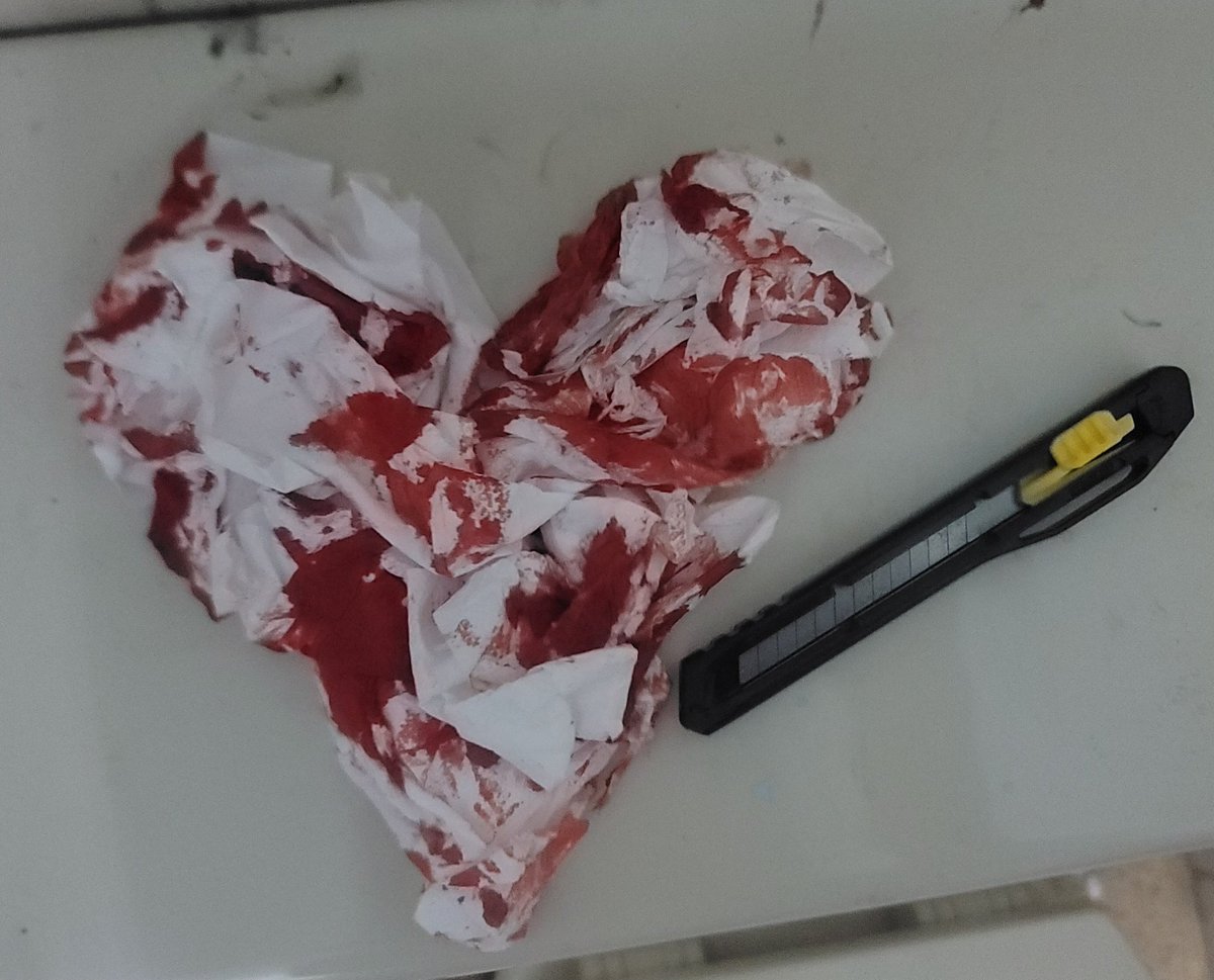 internet_c4ke's tweet photo. old sfx makeup repost !!!! halloween makeup + fake blood heart 𓆩♡𓆪
i remember this makeup got me banned for like a week .... too realistic maybe ?? anyways everything is fake !!!! #shrtwt #styrotwt #slittwt #ouchietwt https://t.co/JrvY2i7B6u