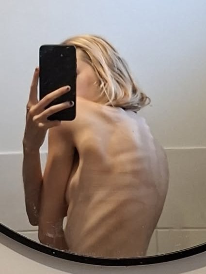Ellarexia's tweet photo. Bmi guesses? https://t.co/Aj0fOgk2Xu