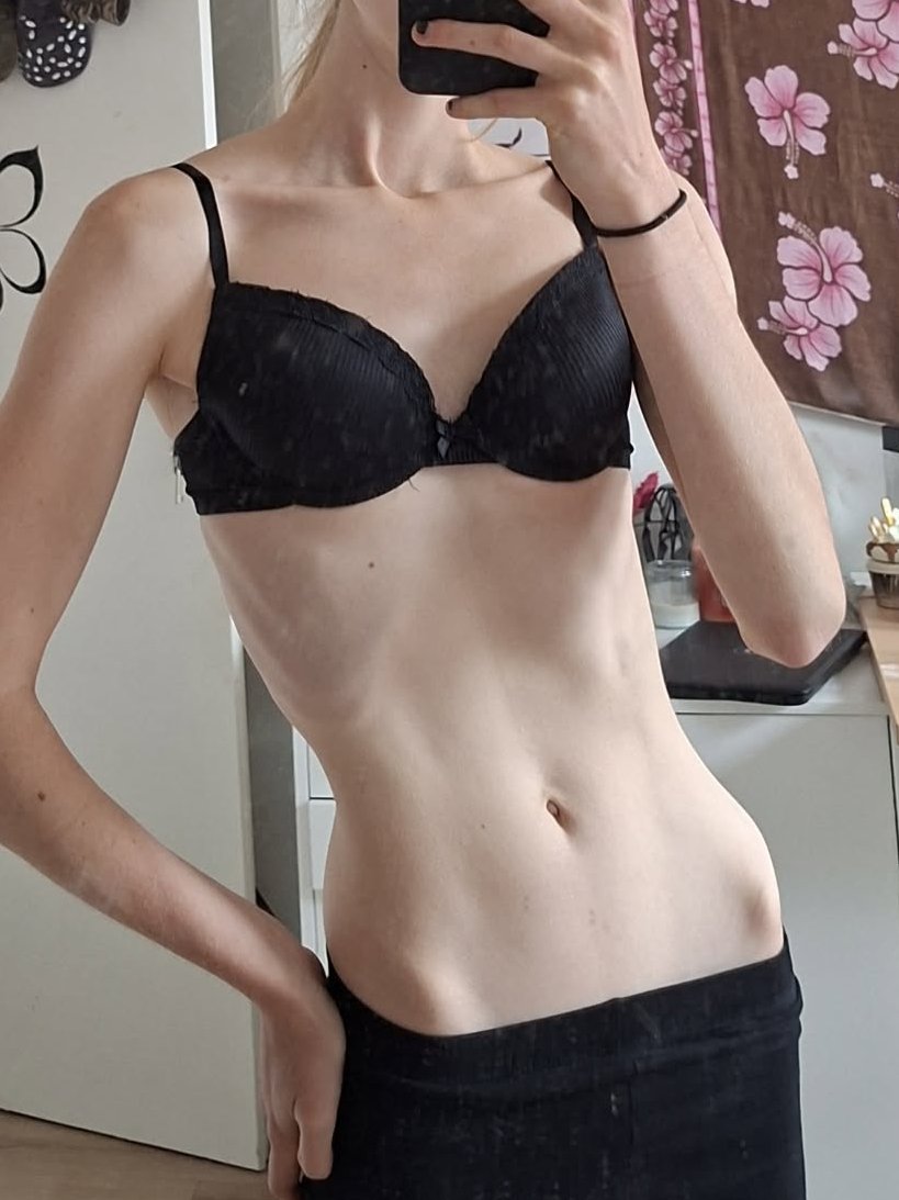 Ellarexia's tweet photo. Bmi guesses? https://t.co/Aj0fOgk2Xu