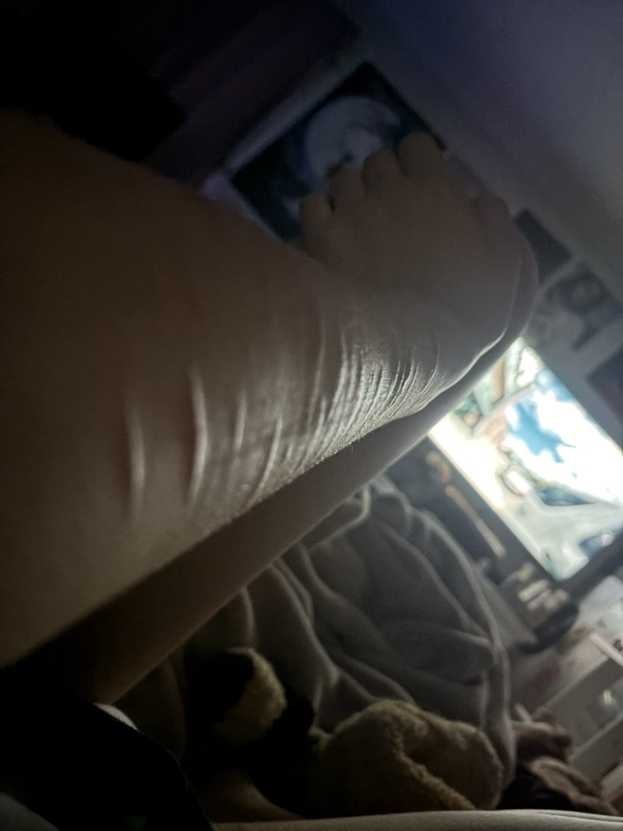 r4insh's tweet photo. scarssss😻😻 #sh #scars #shtwt https://t.co/AbqdXYzvHb