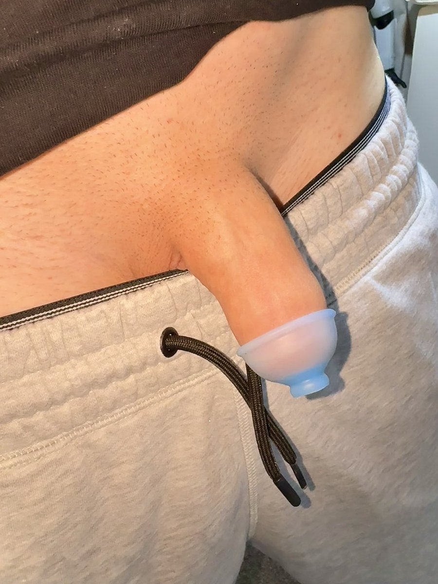 ForeRestoring's tweet photo. Wearing a retainer every night and when not actively stretching has been a game changer with dekeratinization and bringing back sensitivity 🙌🏼 it’s a must have for anyone restoring they’re foreskin 100% 
#circumcised
#foreskinrestoration https://t.co/WNjDvmQHt0