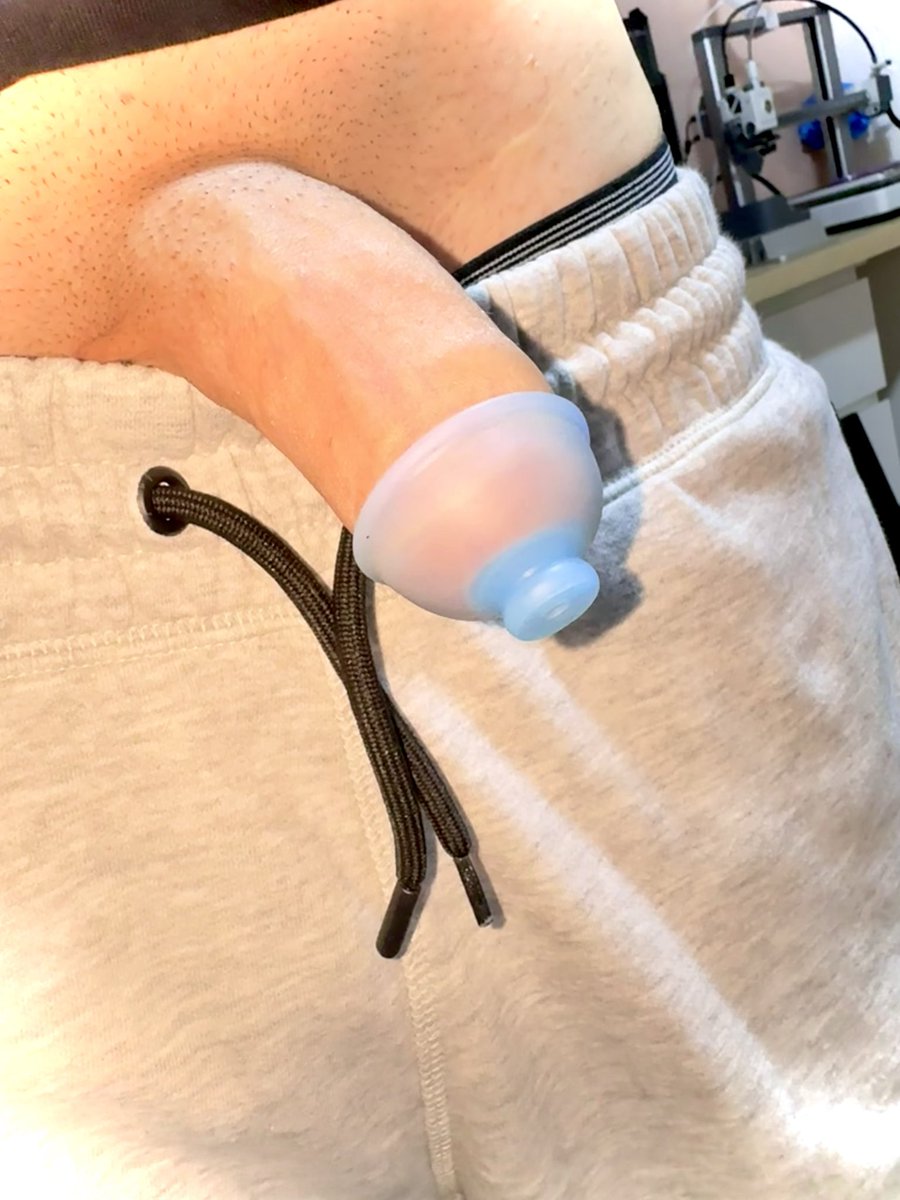 ForeRestoring's tweet photo. Wearing a retainer every night and when not actively stretching has been a game changer with dekeratinization and bringing back sensitivity 🙌🏼 it’s a must have for anyone restoring they’re foreskin 100% 
#circumcised
#foreskinrestoration https://t.co/WNjDvmQHt0