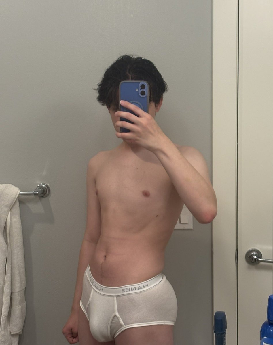 Loatoppo's tweet photo. can see the beginnings of twink death on me… I must not let it come to pass https://t.co/25qQr0UO8j