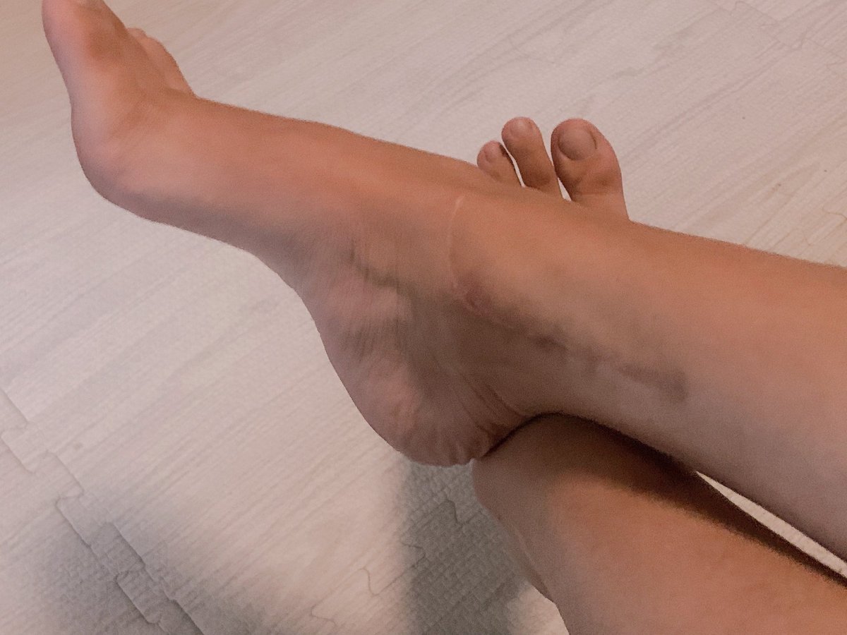 Ellecyad's tweet photo. So I got this cool surgery scar
When people ask about this scar i lied I fought with wild crocodile and I won https://t.co/cw3qgLgFcd