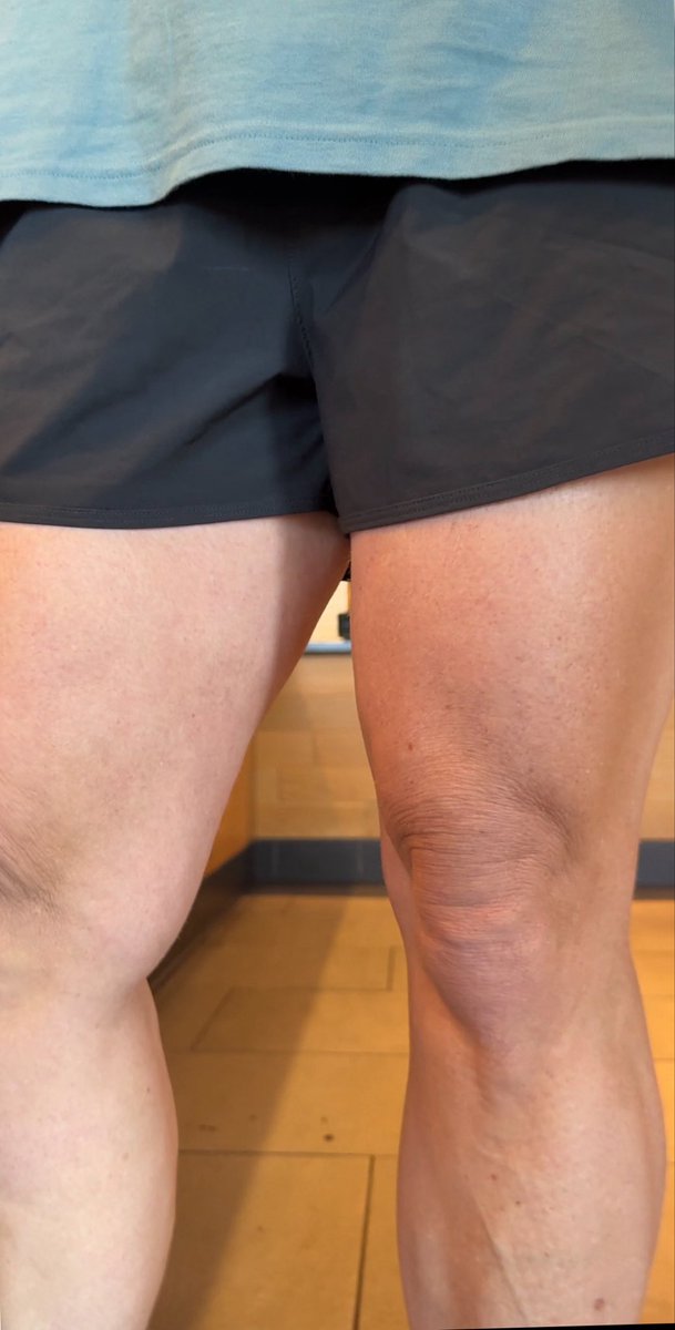drifterknight2k's tweet photo. You ever get such a massive hard on after seeing woman’s legs out here in these shorts that your boner is so intense, raging and throbbing that it forces you to sit down #shorts #gooner #raging #juggalo #beastmode https://t.co/dxnLYEjuSU